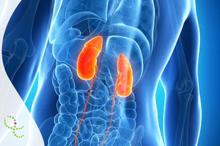 Glomerulopatia G3 (C3G)