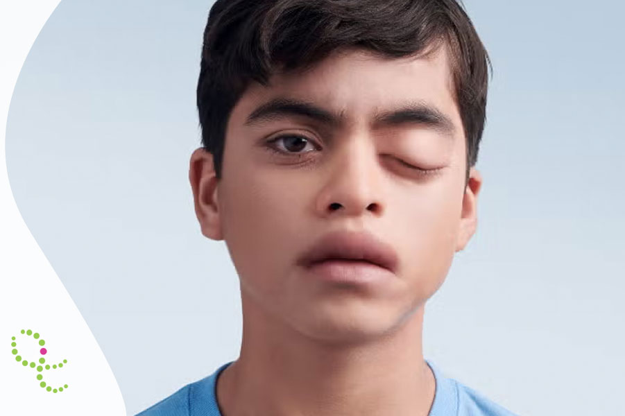 Angioedema Hereditário (AEH)