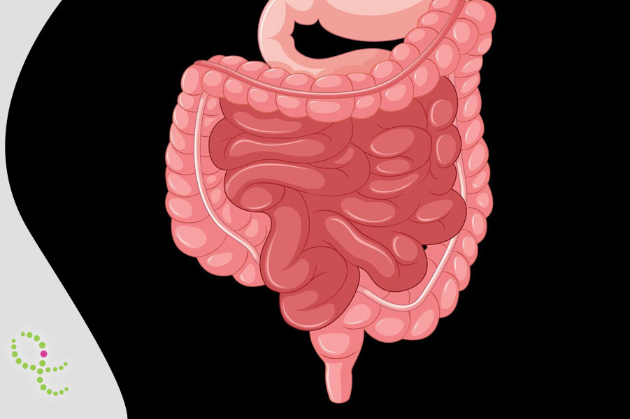 Enterocolite Necrosante (ECN)